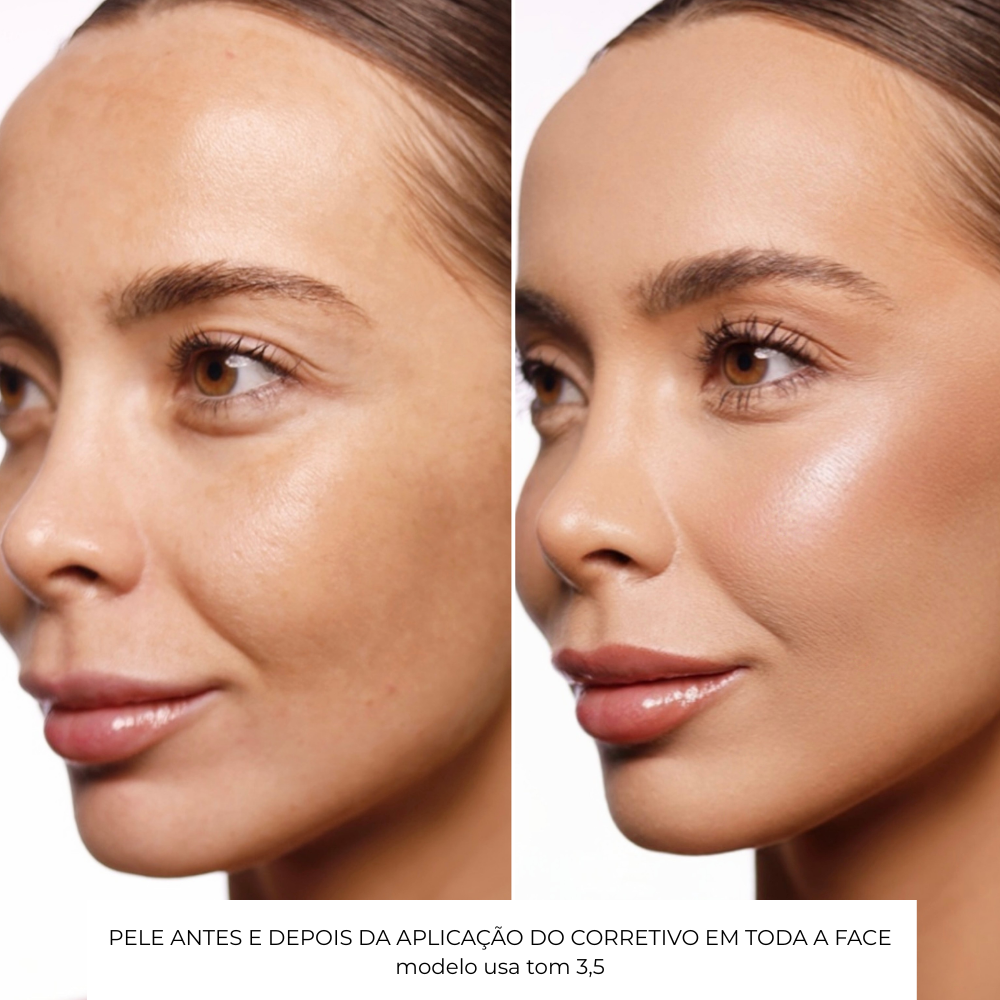 Aux&iacute;lio na compra